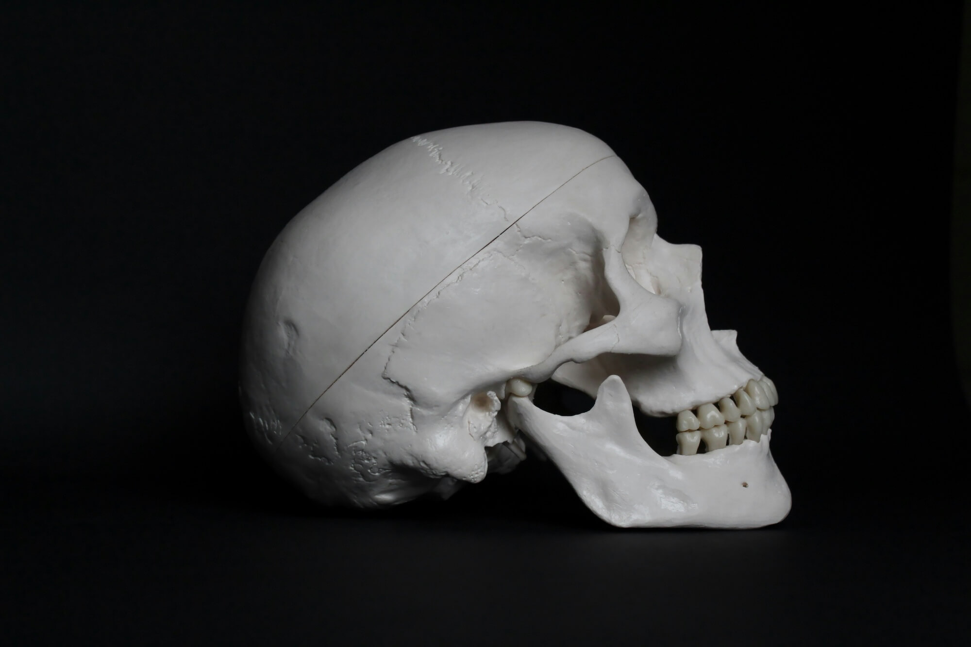 articulación temporomandibular